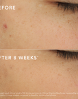 c-bright-dark-spot-corrector
