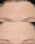SeneCell™ SenePlex+® StemCell Concentrate