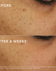 c-bright-dark-spot-corrector