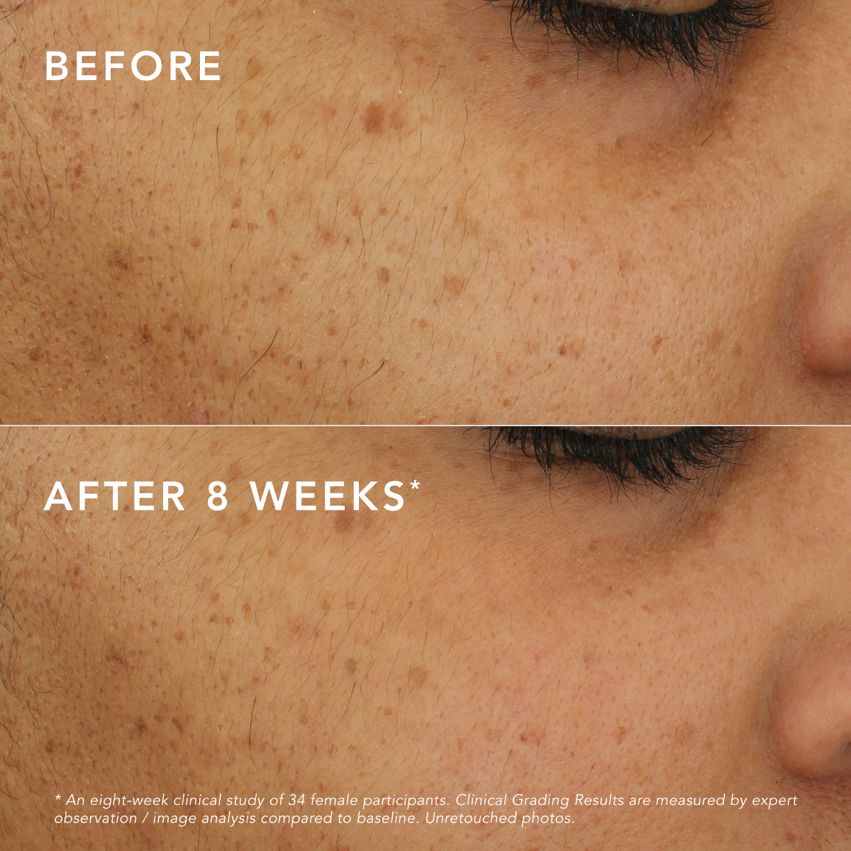 C-Bright Dark Spot Corrector - Default Title