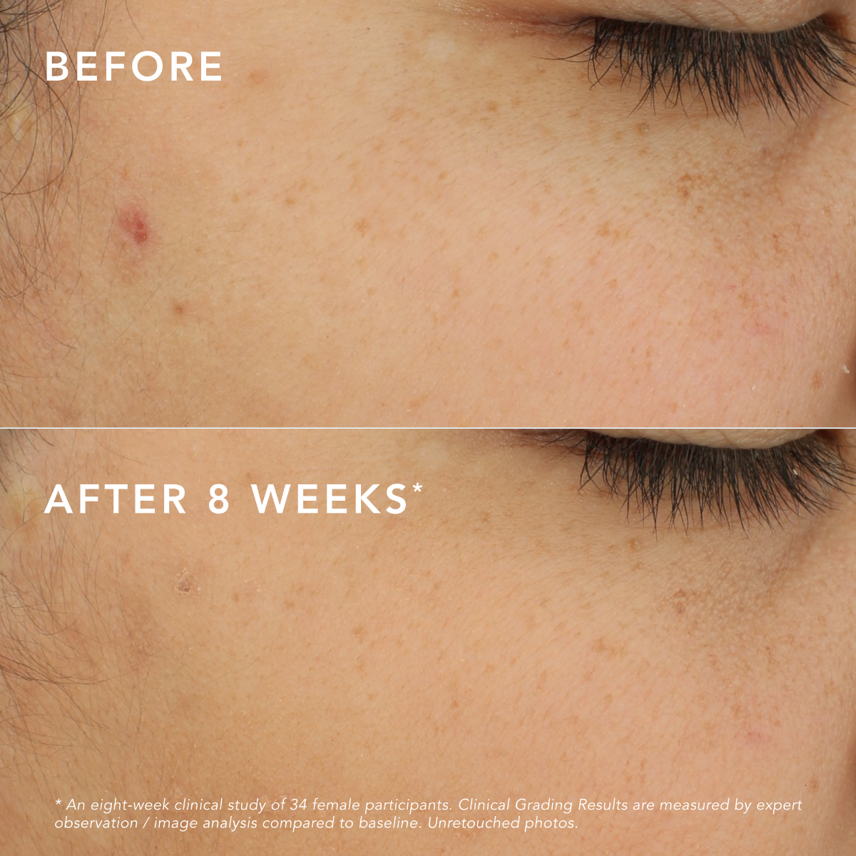 C-Bright Dark Spot Corrector - Default Title