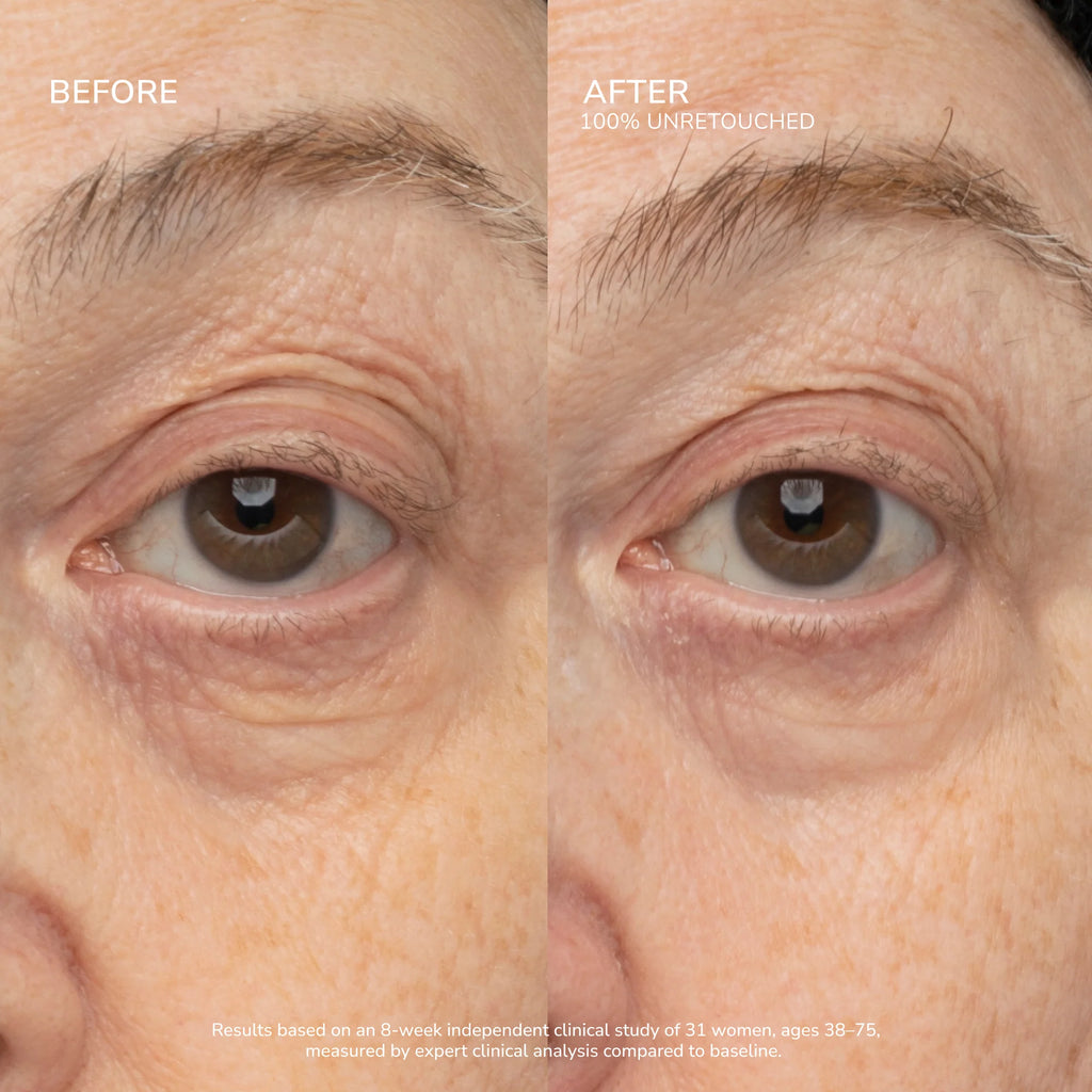 SeneCell™ SenePlex+® StemCell Concentrate MEX