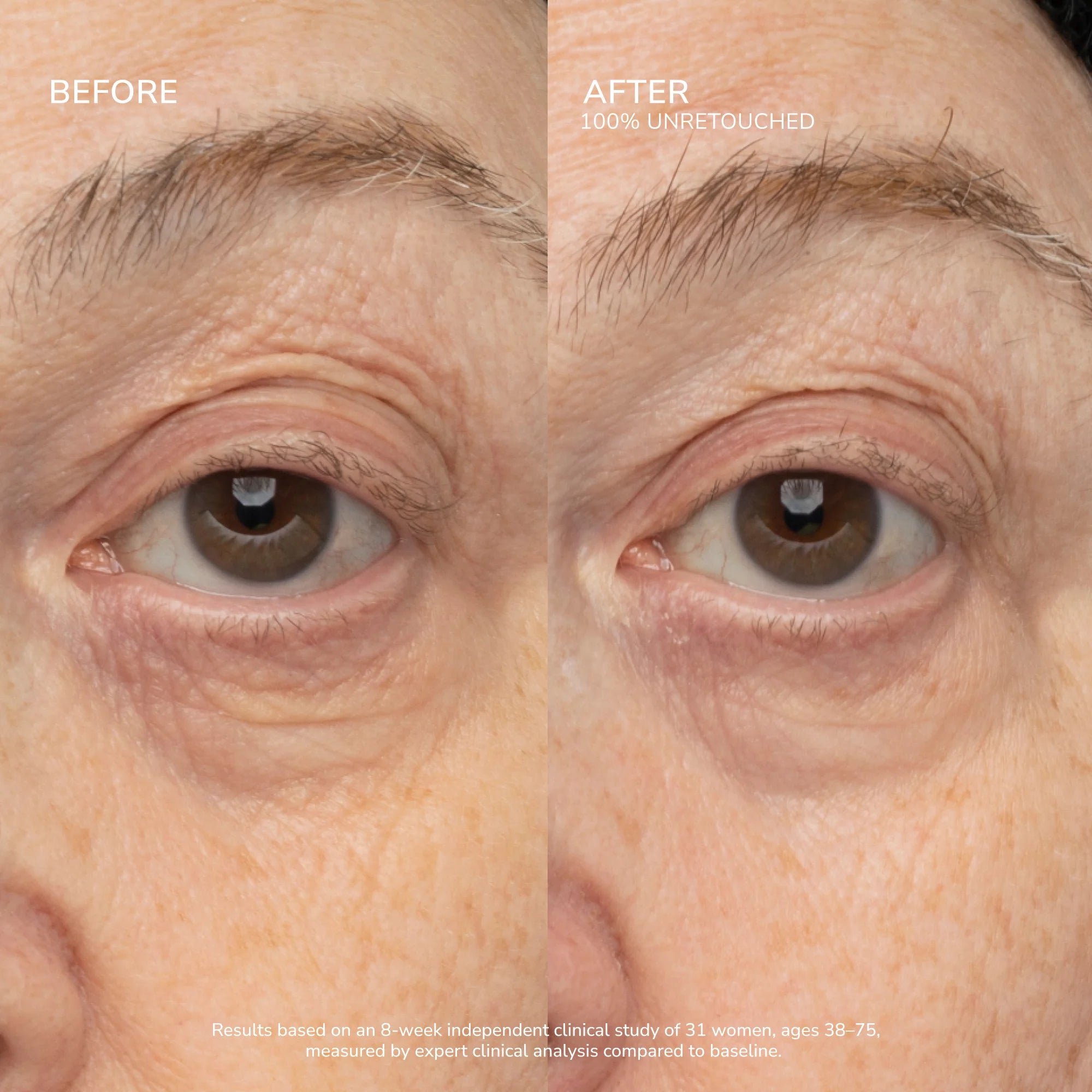 SeneCell™ SenePlex+® StemCell Concentrate MEX